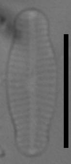 Масштаб - 10 мкм., Рузский район, Moscow Oblast (Russia)