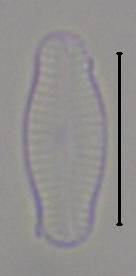 Масштаб - 10 мкм., Рузский район, Moscow Oblast (Russia)