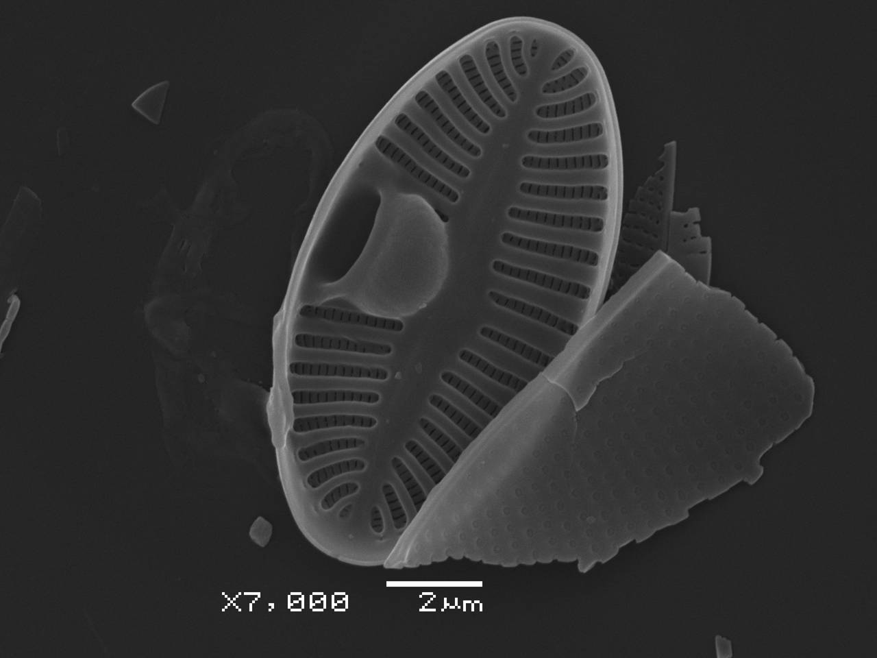 Масштаб - 10 мкм., Рузский район, Moscow Oblast (Russia)