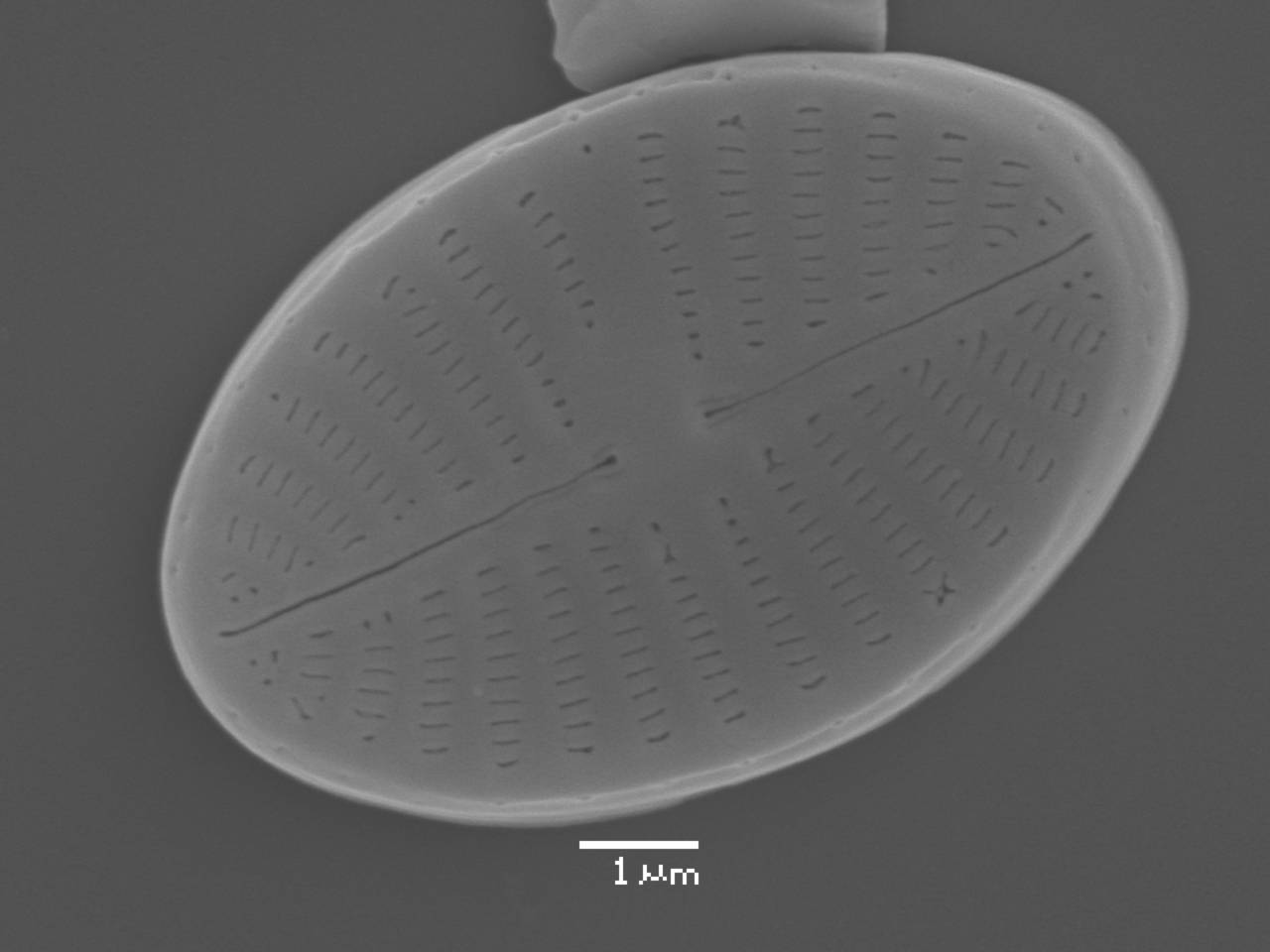 Масштаб - 10 мкм., Рузский район, Moscow Oblast (Russia)