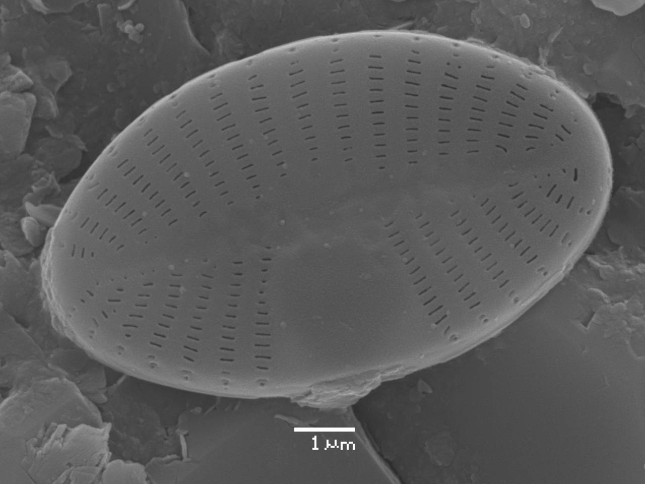 Масштаб - 10 мкм., Рузский район, Moscow Oblast (Russia)