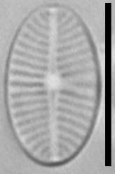 Масштаб - 10 мкм., Рузский район, Moscow Oblast (Russia)