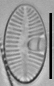 Масштаб - 10 мкм., Рузский район, Moscow Oblast (Russia)