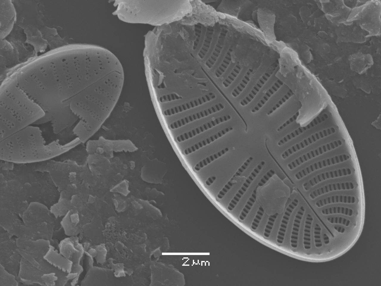 Масштаб - 10 мкм., Рузский район, Moscow Oblast (Russia)