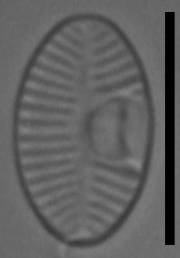 Масштаб - 10 мкм, Рузский район, Moscow Oblast (Russia)