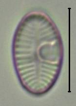 Масштаб - 10 мкм., Рузский район, Moscow Oblast (Russia)