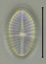 Масштаб - 10 мкм., Рузский район, Moscow Oblast (Russia)