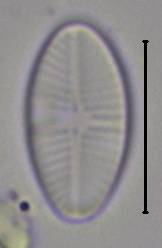 Масштаб - 10 мкм., Рузский район, Moscow Oblast (Russia)