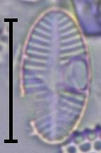 Масштаб - 10 мкм., Рузский район, Moscow Oblast (Russia)