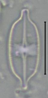 Масштаб - 10 мкм., Рузский район, Moscow Oblast (Russia)