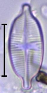 Масштаб - 10 мкм., Рузский район, Moscow Oblast (Russia)