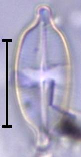 Масштаб - 10 мкм., Рузский район, Moscow Oblast (Russia)