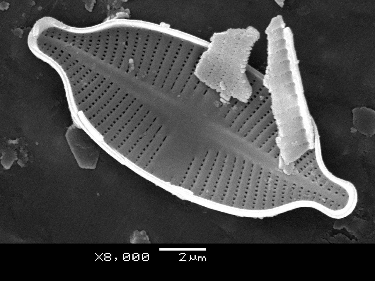 Масштаб - 10 мкм., Рузский район, Moscow Oblast (Russia)
