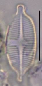 Масштаб - 10 мкм., Рузский район, Moscow Oblast (Russia)