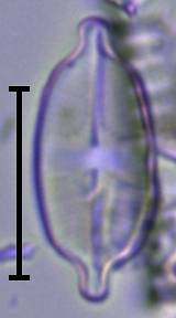 Масштаб - 10 мкм., Рузский район, Moscow Oblast (Russia)