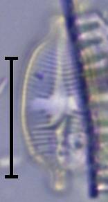 Масштаб - 10 мкм., Рузский район, Moscow Oblast (Russia)