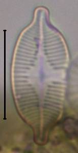 Масштаб - 10 мкм., Рузский район, Moscow Oblast (Russia)