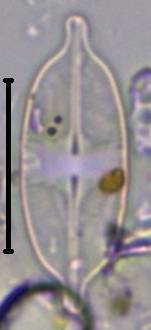 Масштаб - 10 мкм., Рузский район, Moscow Oblast (Russia)