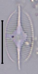 Масштаб - 10 мкм., Рузский район, Moscow Oblast (Russia)