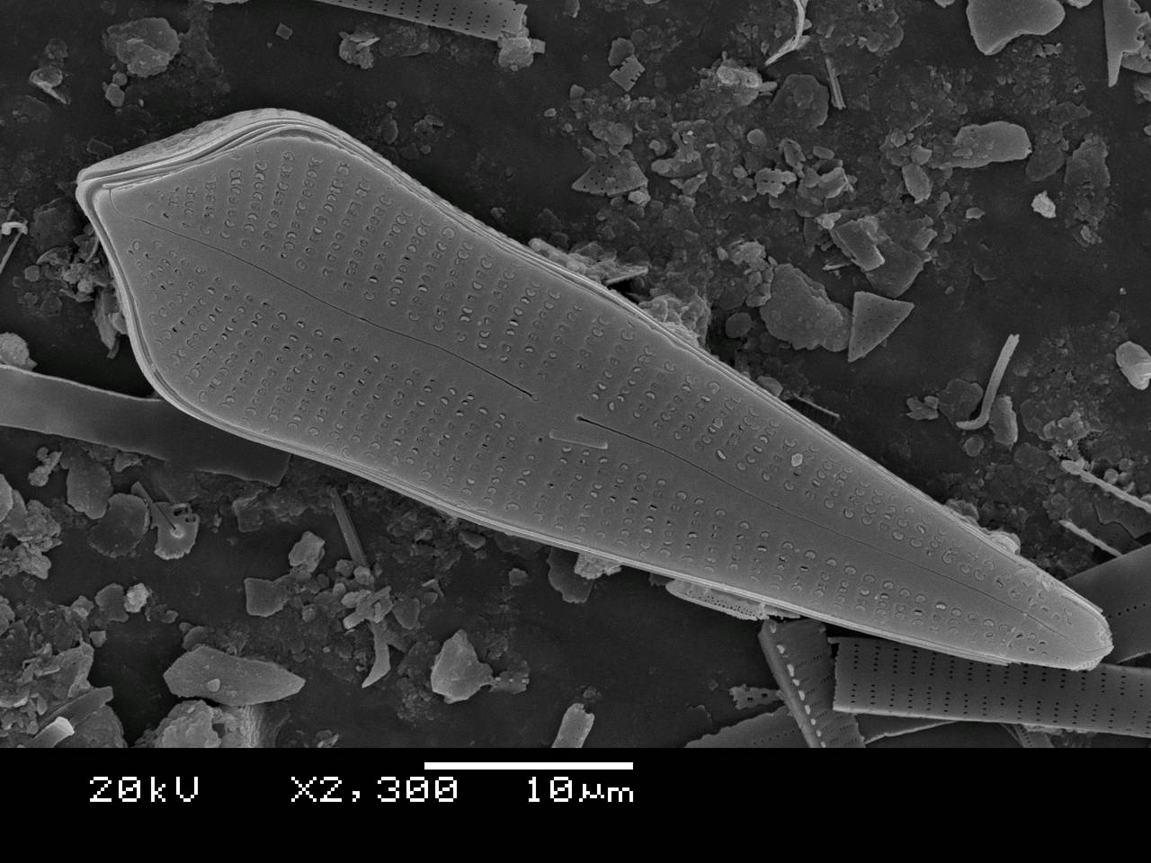 Масштаб - 10 мкм., Рузский район, Moscow Oblast (Russia)