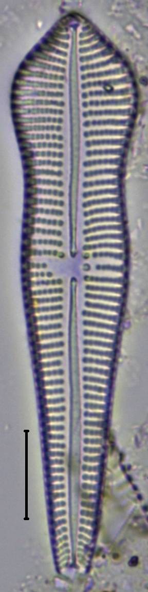 Масштаб - 10 мкм.
, Рузский район, Moscow Oblast (Russia)