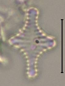 Масштаб - 10 мкм., Рузский район, Moscow Oblast (Russia)