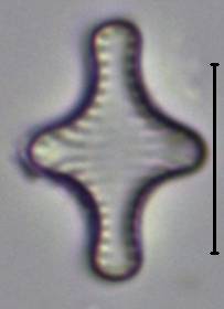 Масштаб - 10 мкм., Рузский район, Moscow Oblast (Russia)