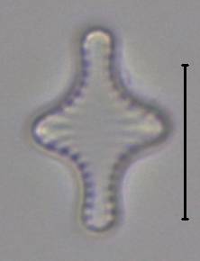 Масштаб - 10 мкм., Рузский район, Moscow Oblast (Russia)