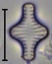 Масштаб - 10 мкм., Рузский район, Moscow Oblast (Russia)