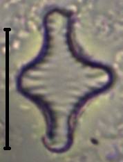 Масштаб - 10 мкм.
, Рузский район, Moscow Oblast (Russia)