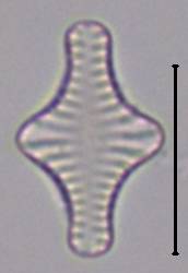 Масштаб - 10 мкм.
, Рузский район, Moscow Oblast (Russia)