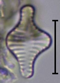 Масштаб - 10 мкм., Рузский район, Moscow Oblast (Russia)