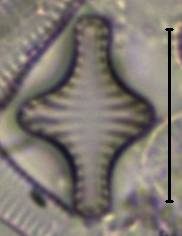 Масштаб - 10 мкм., Рузский район, Moscow Oblast (Russia)