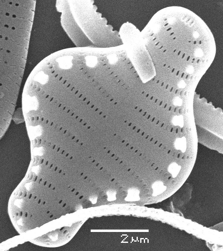 Масштаб - 10 мкм.
, Рузский район, Moscow Oblast (Russia)