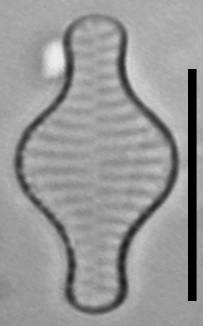 Масштаб - 10 мкм., Рузский район, Moscow Oblast (Russia)