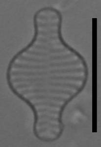 Масштаб - 10 мкм., Рузский район, Moscow Oblast (Russia)