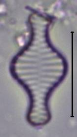 Масштаб - 10 мкм., Рузский район, Moscow Oblast (Russia)