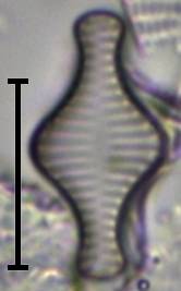 Масштаб - 10 мкм., Рузский район, Moscow Oblast (Russia)