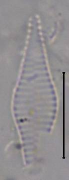 Масштаб - 10 мкм., Рузский район, Moscow Oblast (Russia)