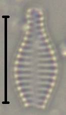 Масштаб - 10 мкм., Рузский район, Moscow Oblast (Russia)