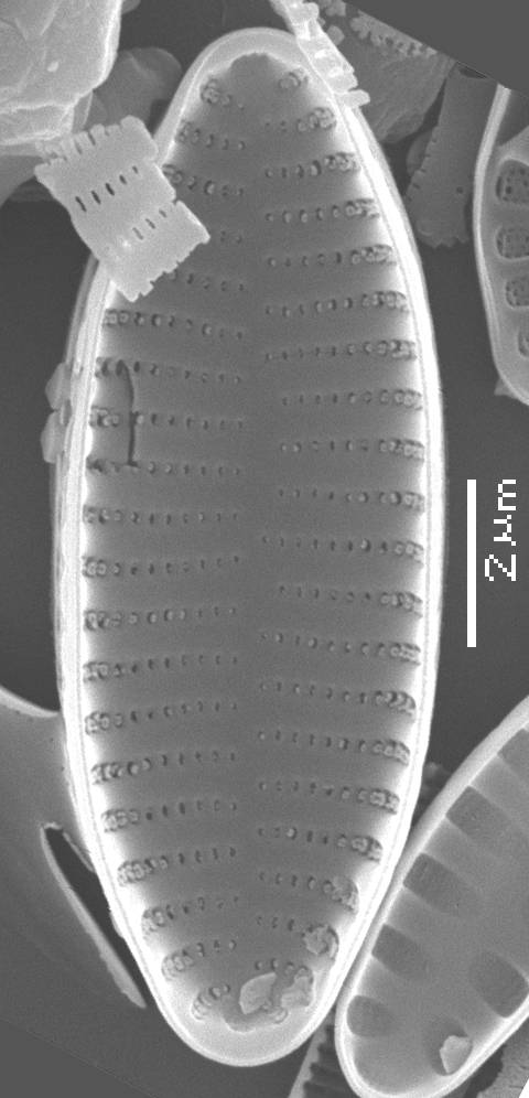 Масштаб - 10 мкм., Рузский район, Moscow Oblast (Russia)