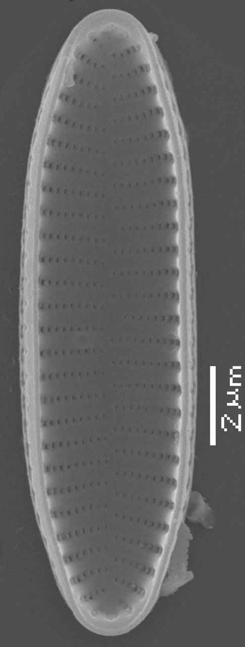 Масштаб - 10 мкм., Рузский район, Moscow Oblast (Russia)