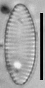 Масштаб - 10 мкм., Рузский район, Moscow Oblast (Russia)