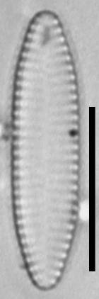 Масштаб - 10 мкм., Рузский район, Moscow Oblast (Russia)