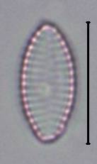 Масштаб - 10 мкм., Рузский район, Moscow Oblast (Russia)