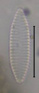 Масштаб - 10 мкм., Рузский район, Moscow Oblast (Russia)