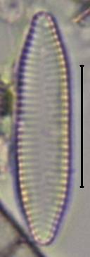 Масштаб - 10 мкм., Рузский район, Moscow Oblast (Russia)