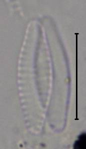 Масштаб - 10 мкм., Рузский район, Moscow Oblast (Russia)