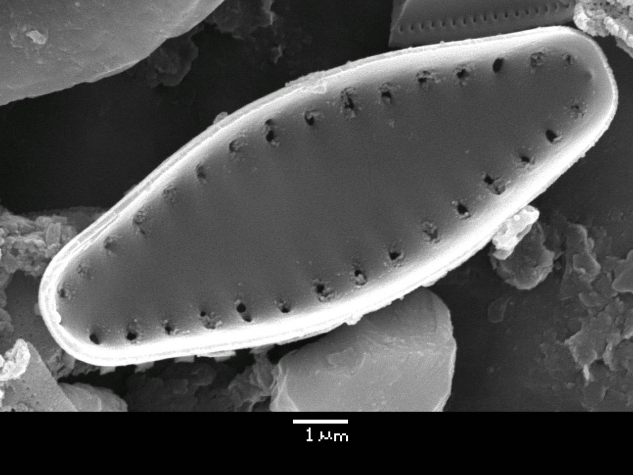 Масштаб - 10 мкм., Рузский район, Moscow Oblast (Russia)