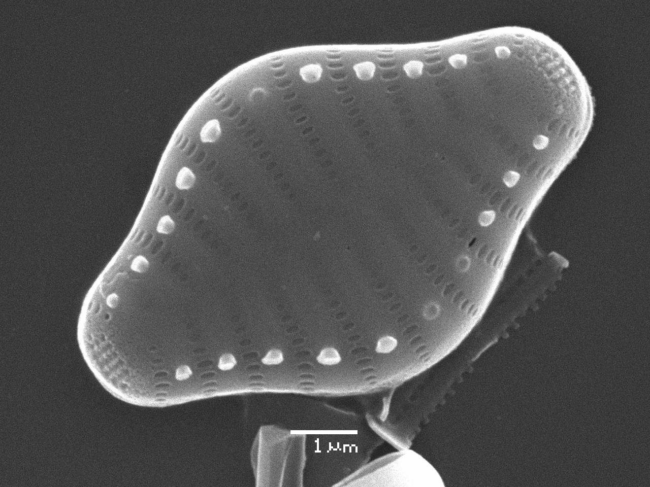 Масштаб - 10 мкм., Рузский район, Moscow Oblast (Russia)